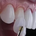 4 üzleti kép ARTICULATIO DENTAL Szépségszalon, kozmetika ban/ben Győr GS