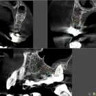 3 üzleti kép J+K DENTAL FOGÁSZAT ÉS SZÁJSEBÉSZET Fogászat, fogszabályzás ban/ben Békéscsaba BC