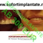 5 üzleti kép SOFORTIMPLANTATE, SOFORT BELASTBARE ZAHNIMPLANTATE, IMPLANTOLOGIE DR CZÍNER ZAHNARZTPRAXIS Fogászat, fogszabályzás ban/ben Sopron GS