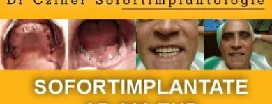 3 üzleti kép SOFORTIMPLANTATE, SOFORT BELASTBARE ZAHNIMPLANTATE, IMPLANTOLOGIE DR CZÍNER ZAHNARZTPRAXIS Fogászat, fogszabályzás ban/ben Sopron GS
