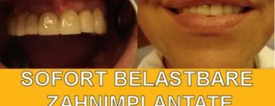 9 üzleti kép SOFORTIMPLANTATE, SOFORT BELASTBARE ZAHNIMPLANTATE, IMPLANTOLOGIE DR CZÍNER ZAHNARZTPRAXIS Fogászat, fogszabályzás ban/ben Sopron GS