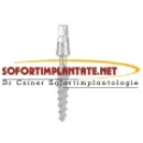 SOFORTIMPLANTATE, SOFORT BELASTBARE ZAHNIMPLANTATE, IMPLANTOLOGIE DR CZÍNER ZAHNARZTPRAXIS Fogászat, fogszabályzás ban/ben Sopron GS